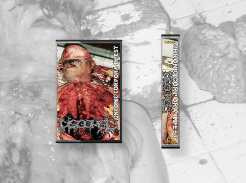 Cassett DISGORGE Chronic Corpora Infest