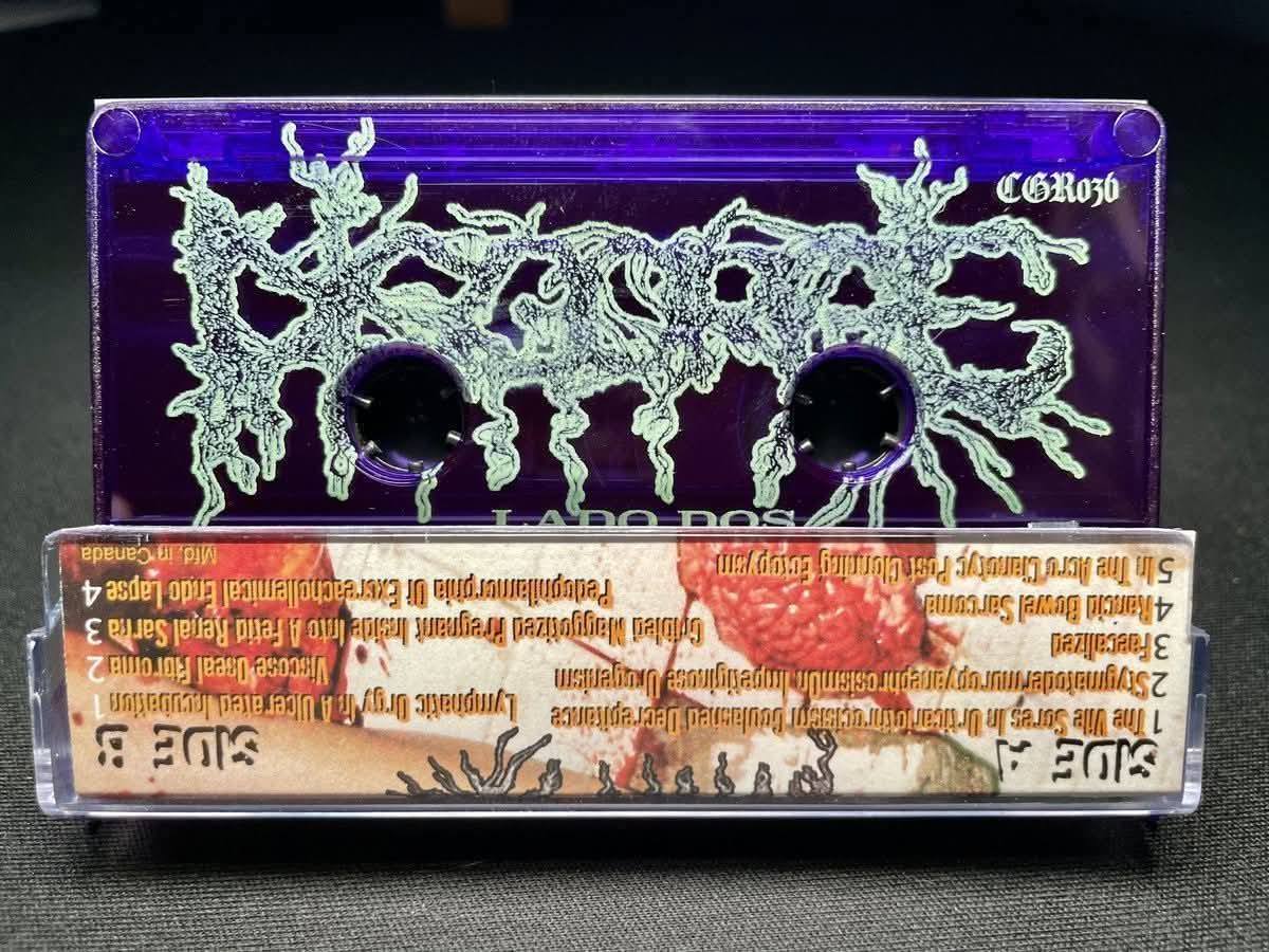Cassett DISGORGE Chronic Corpora Infest